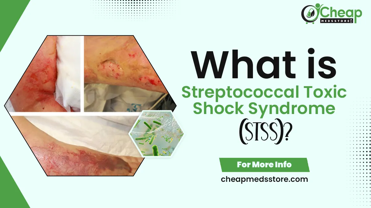What is Streptococcal Toxic Shock Syndrome (STSS)?